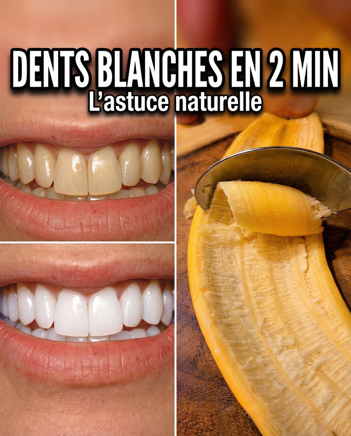 Le secret que les dentistes ne veulent pas que vous sachiez : élimine le tartre et blanchiment des dents en seulement 2 minutes