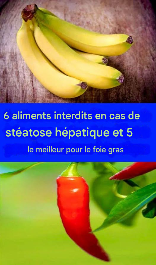 6 aliments à éviter en cas de stéatose hépatique et 5 aliments recommandés en cas de stéatose hépatique