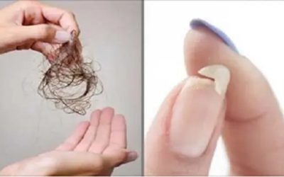 Vous devez manger ceci si vous souffrez de la perte des cheveux, de la faiblesse des ongles ou des troubles de sommeil!