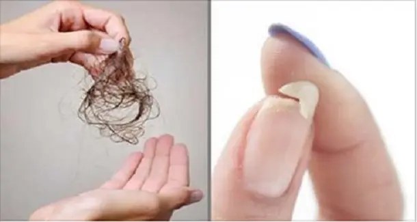 Vous devez manger ceci si vous souffrez de la perte des cheveux, de la faiblesse des ongles ou des troubles de sommeil!