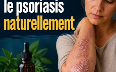 Comment soigner le psoriasis naturellement (lien en commentaire)