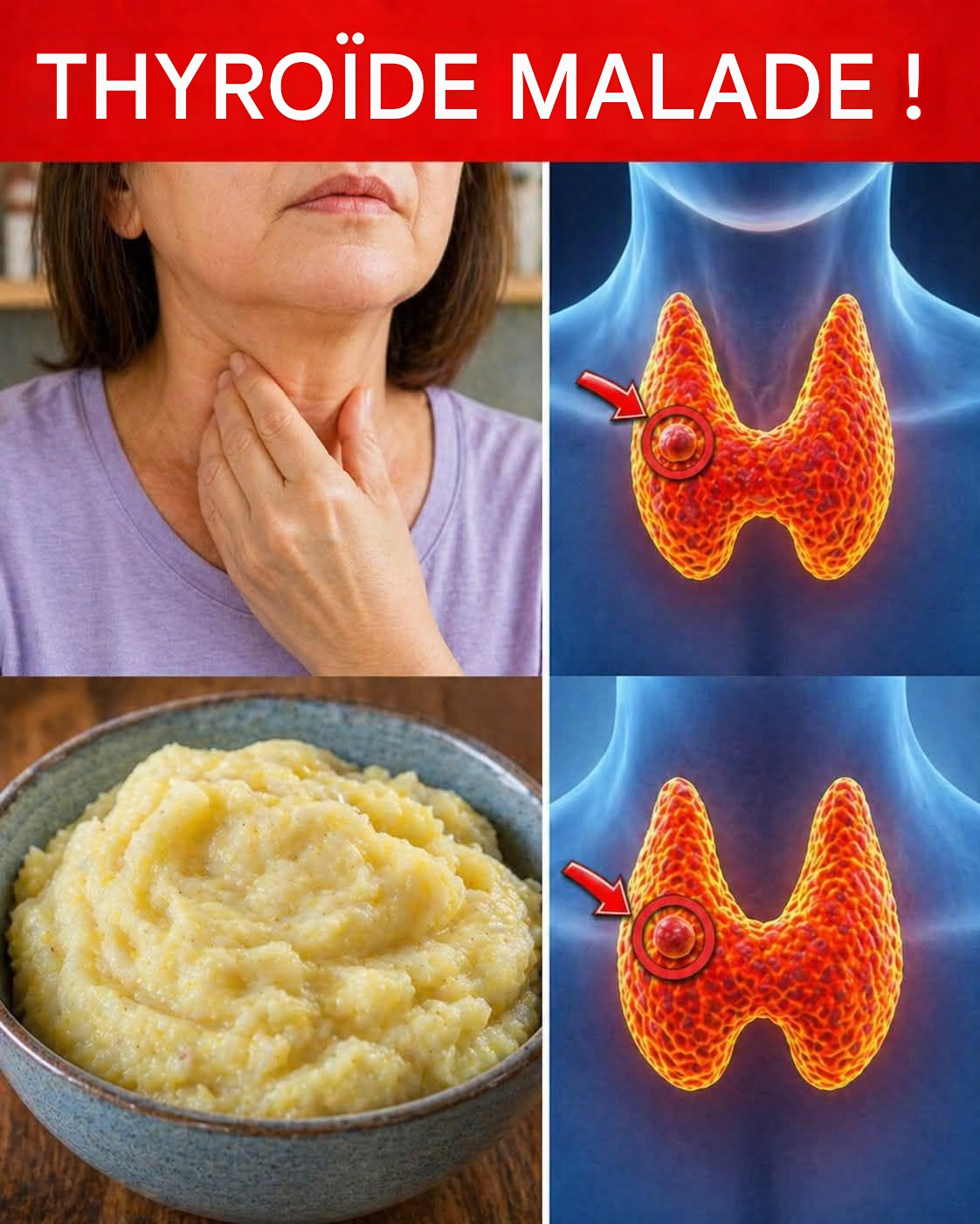 10 aliments avec lesquels vous devriez être prudent si vous souffrez d’hypothyroïdie