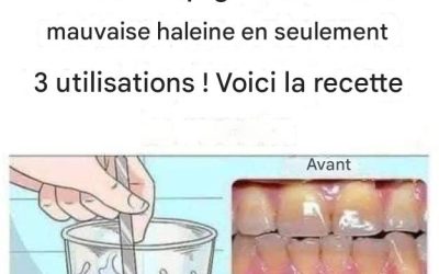 Retirez le tartre de vos dents et blanchissez-les avec cette recette simple.