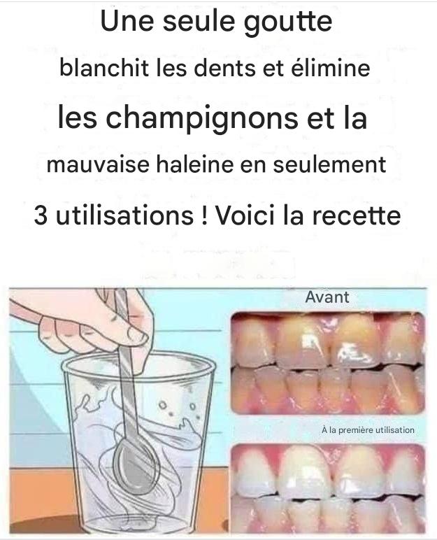 Retirez le tartre de vos dents et blanchissez-les avec cette recette simple.