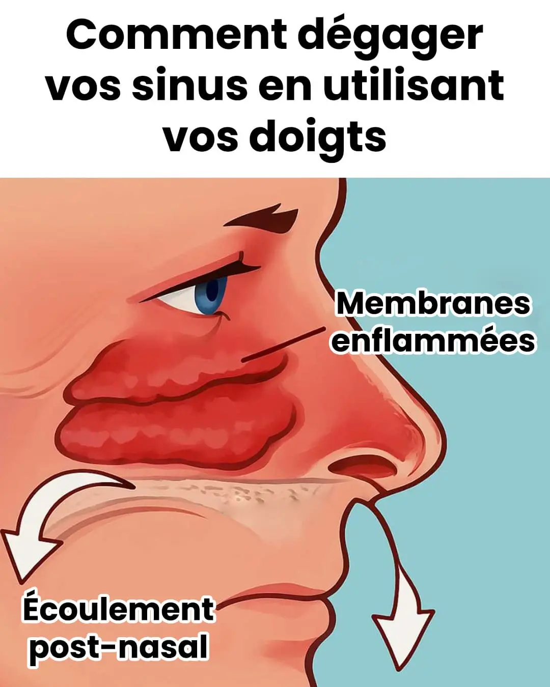 3 astuces naturelles pour libérer vos voies nasales en un instant