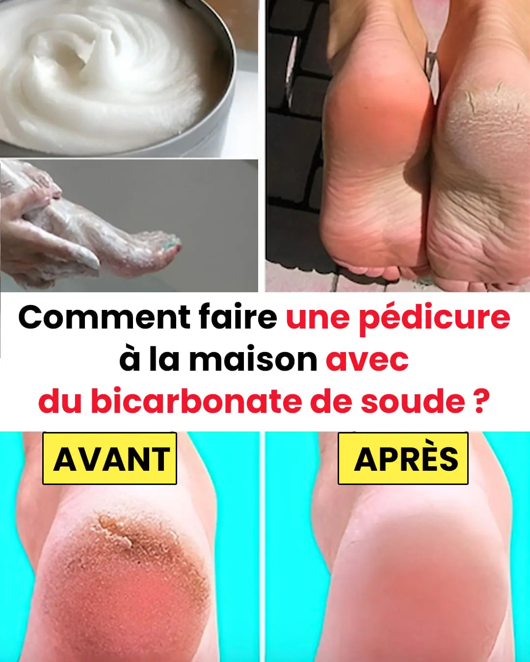 Offrez-vous une pédicure digne d’un spa avec un ingrédient de cuisine : le bicarbonate de soude.