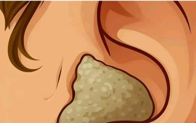 8 solutions douces et sans risque pour dire adieu aux bouchons de cérumen