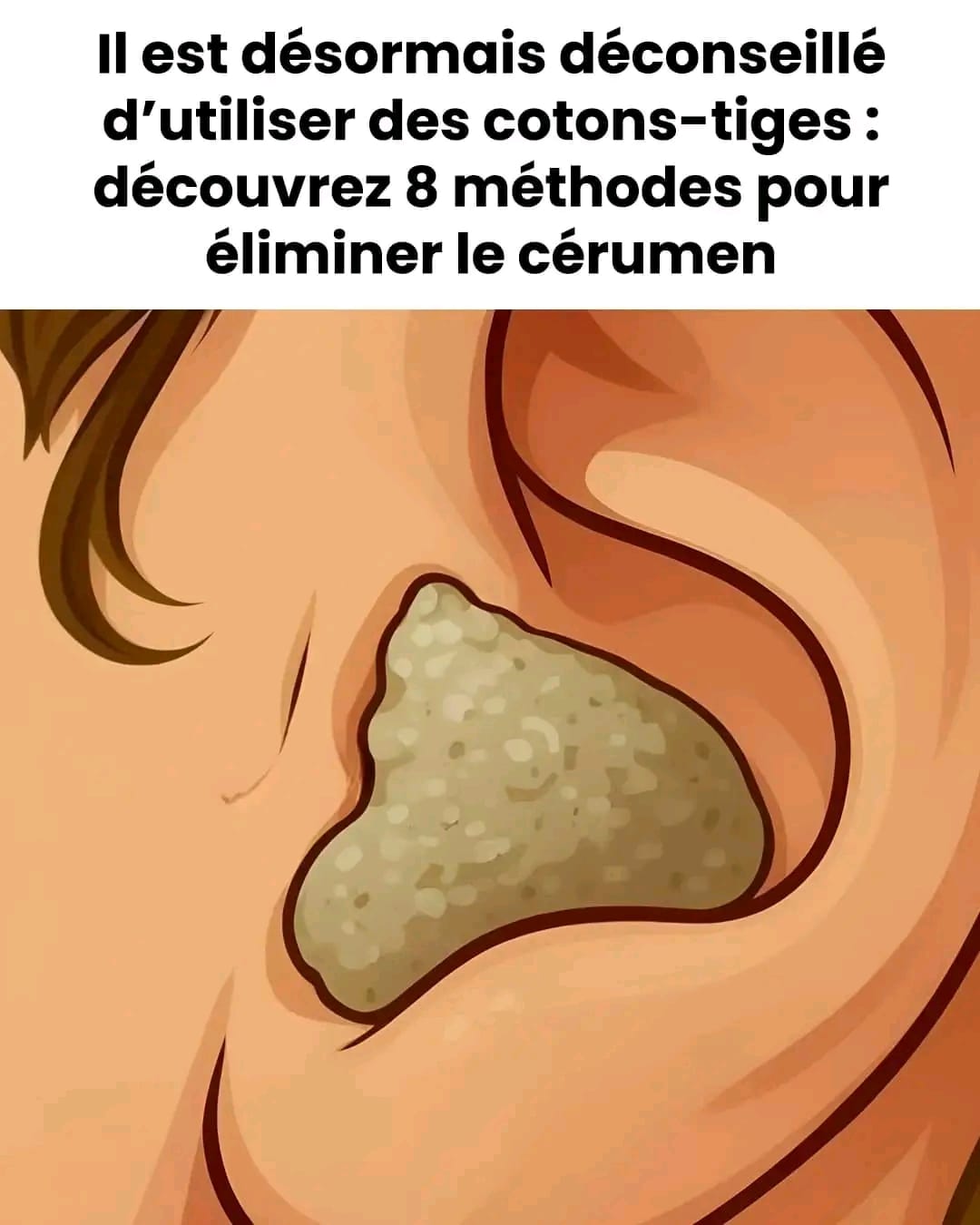 8 solutions douces et sans risque pour dire adieu aux bouchons de cérumen