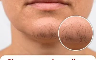 Si vous êtes une femme avec des poils au menton, voici ce que cela signifie vraiment
