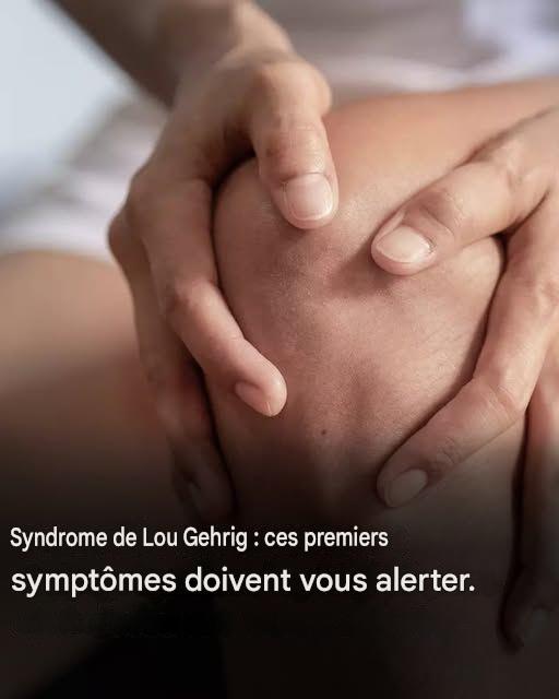 Syndrome de Lou Gehrig : voici les premiers symptômes de cette maladie