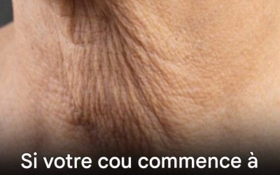 Pourquoi la peau du cou se relâche avec l’âge — et que faire pour y remédier