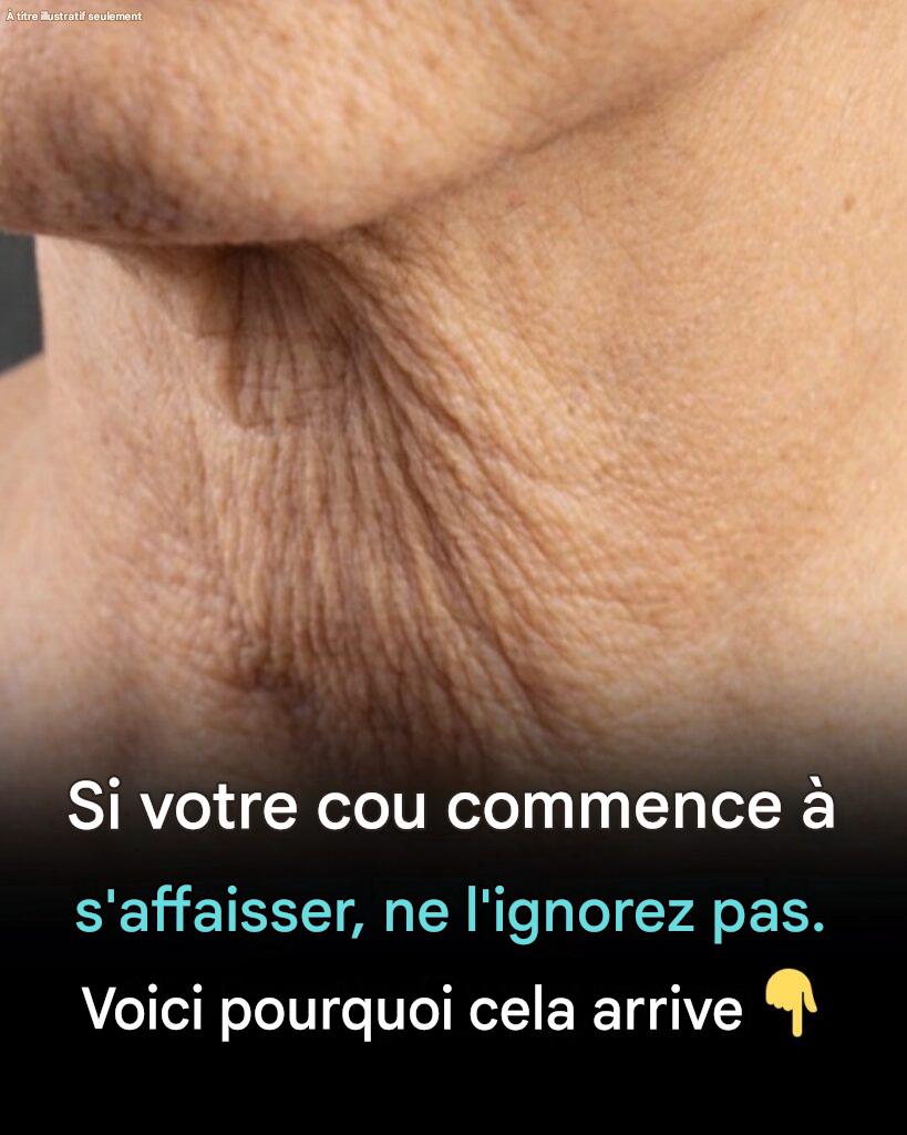 Pourquoi la peau du cou se relâche avec l’âge — et que faire pour y remédier