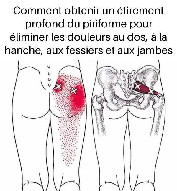 Comment obtenir un étirement profond du piriforme pour éliminer les douleurs au dos, à la hanche, aux fessiers et aux jambes
