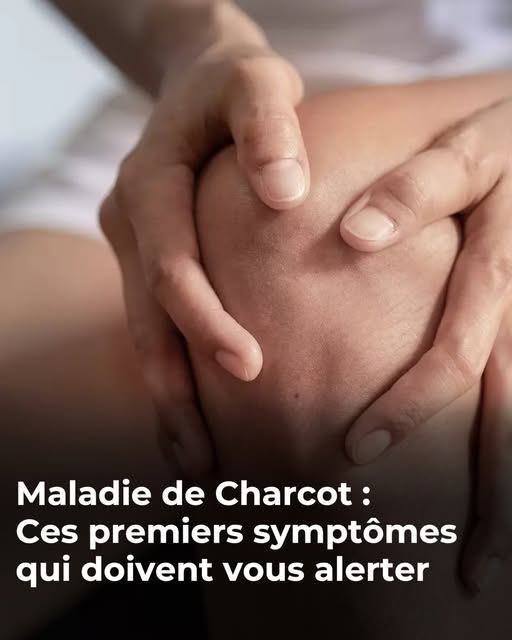 Maladie de Charcot : voici les premiers symptômes de cette affection