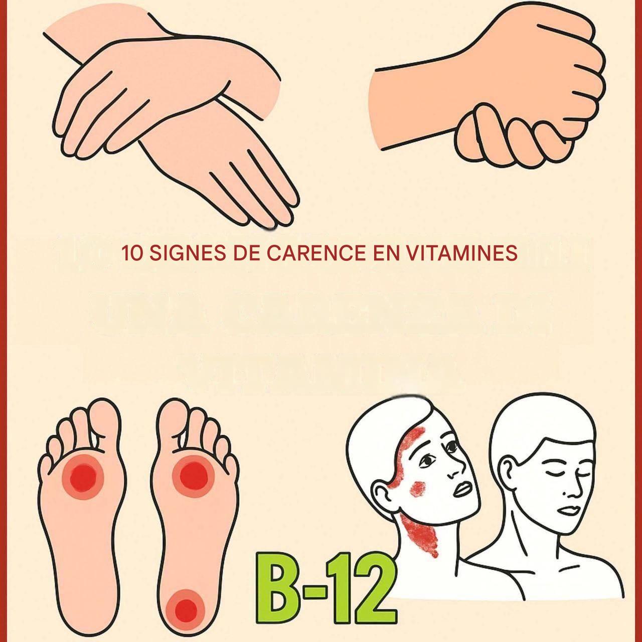 Vitamine B12, 10 symptômes indiquant une carence : attention au numéro 3 (1 / 2)