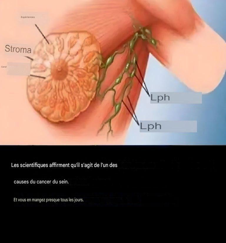 90 % des cas de cancer du sein pourraient être évités si les femmes suivaient ces 9 règles.