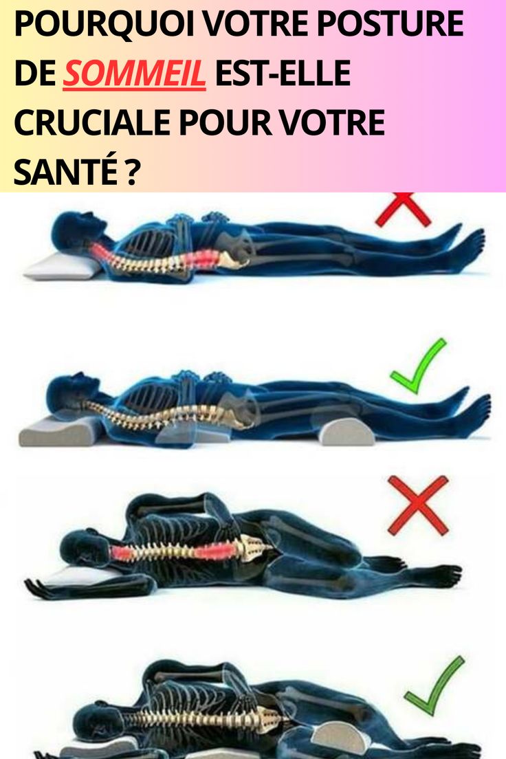 Pourquoi votre posture de sommeil est-elle cruciale pour votre santé ?