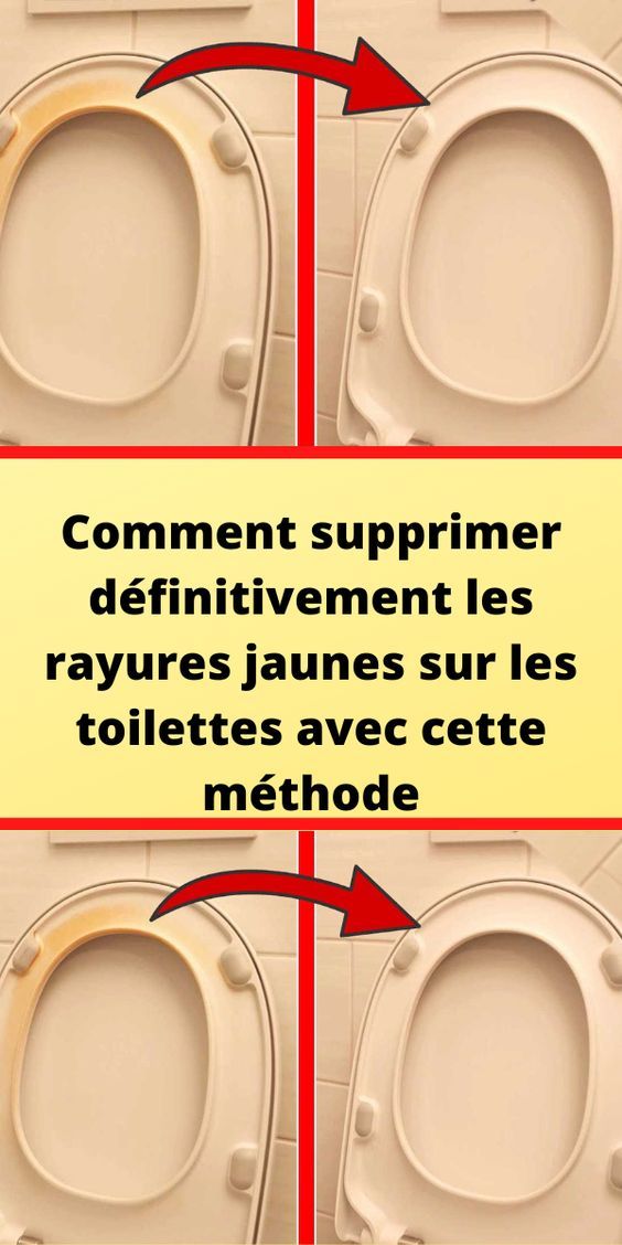 Comment supprimer définitivement les rayures jaunes sur les toilettes avec cette méthode