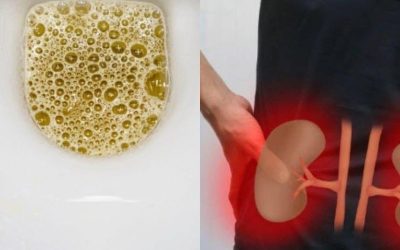 Urine mousseuse : voici pourquoi vous pourriez remarquer des bulles dans votre urine