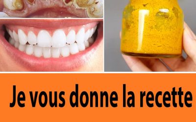 Formule Secrète De Dentiste: Enlever La Plaque Dentaire En 2 Minutes Avec Ce Dentifrice