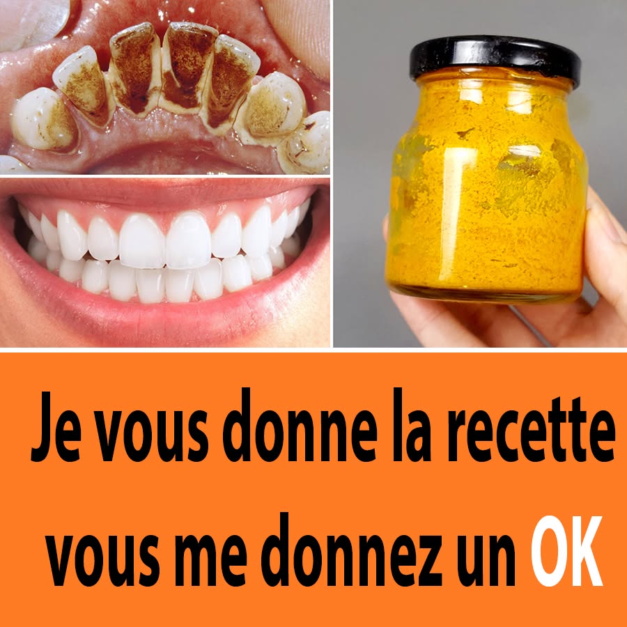 Formule Secrète De Dentiste: Enlever La Plaque Dentaire En 2 Minutes Avec Ce Dentifrice