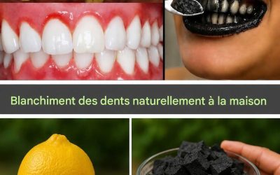 Citron et charbon de bois pour le blanchiment des dents : ce remède DIY fonctionne-t-il vraiment ? éditeur le 28 juillet 2026Laisser un commentaire