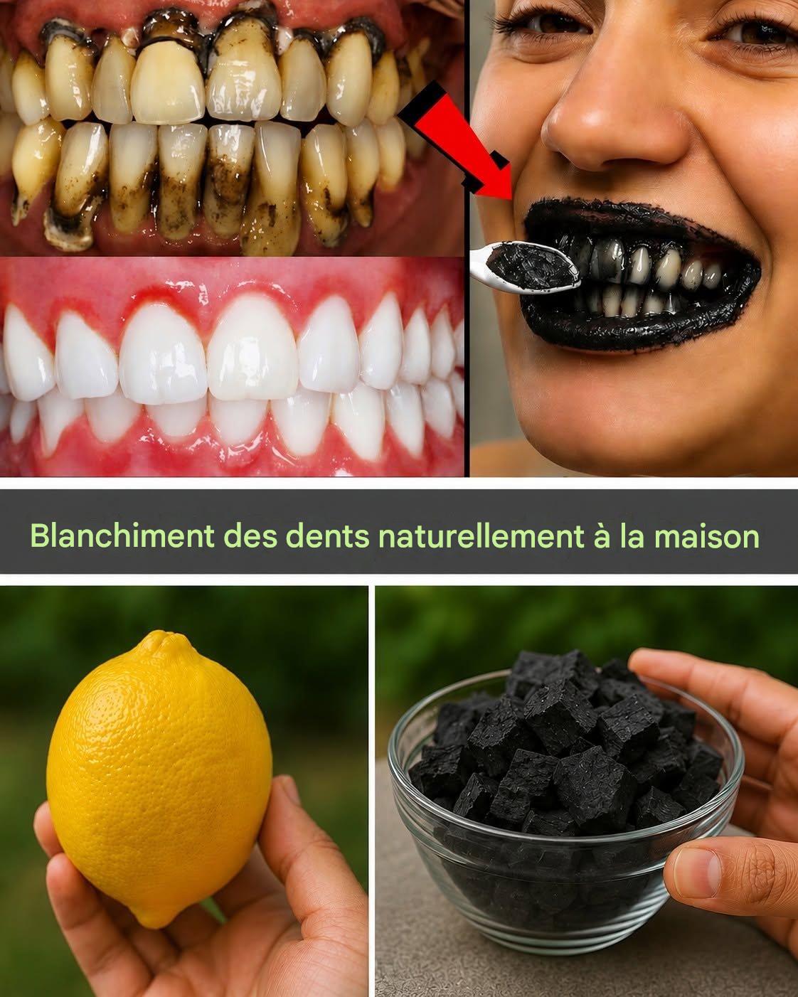 Citron et charbon de bois pour le blanchiment des dents : ce remède DIY fonctionne-t-il vraiment ? éditeur le 28 juillet 2026Laisser un commentaire