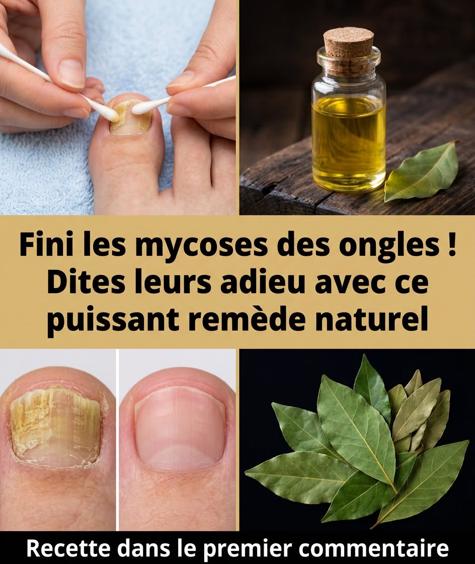 Le laurier, votre nouvel allié cuisine pour des ongles en pleine santé