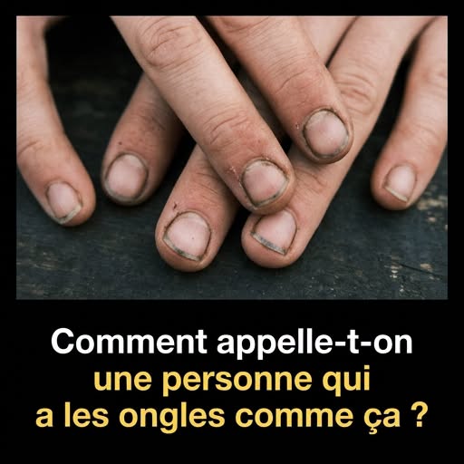Ce que l’état de vos ongles révèle vraiment sur vous (et ce n’est pas ce que vous croyez)