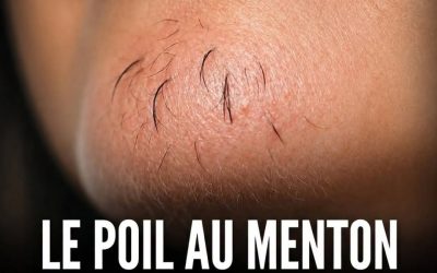 Poils sur le menton chez la femme : ce que votre corps essaie peut-être de vous dire
