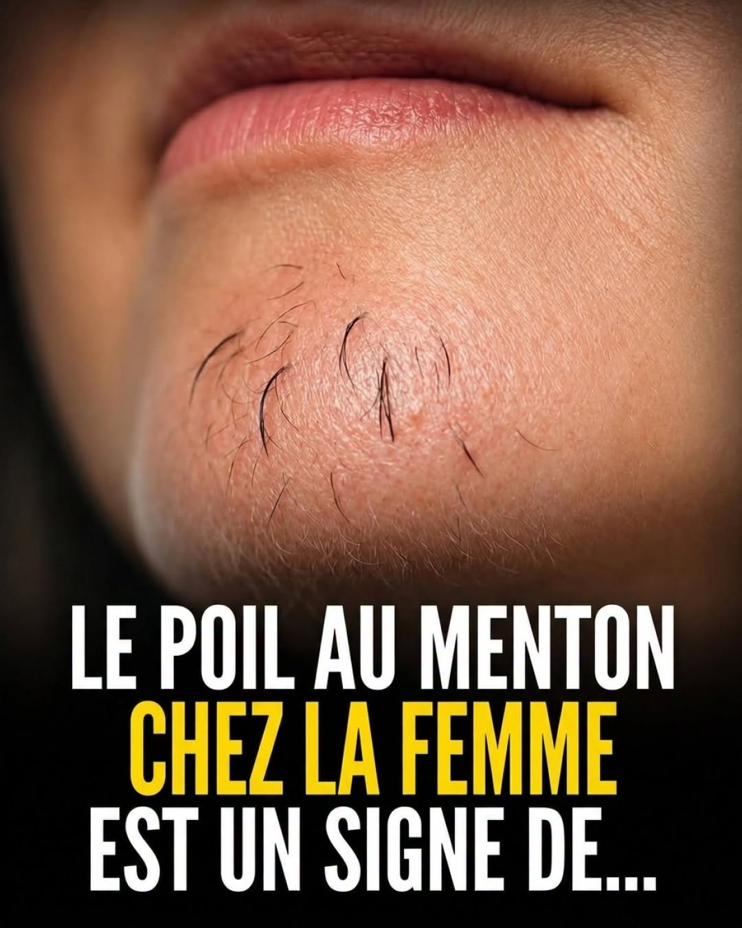 Poils sur le menton chez la femme : ce que votre corps essaie peut-être de vous dire
