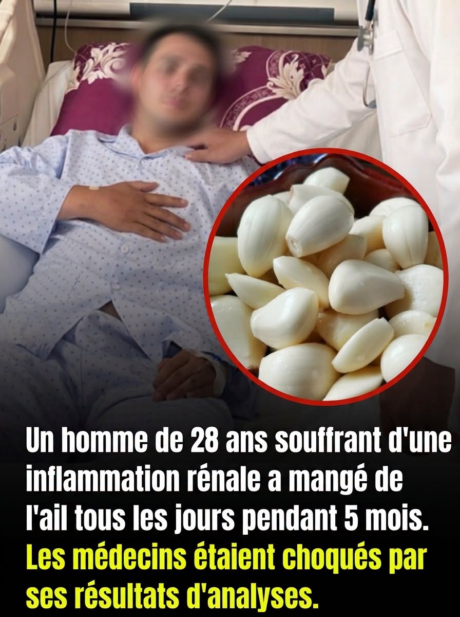 Il mange de l’ail tous les jours pendant 5 mois avec une inflammation rénale : ce que révèlent ses analyses
