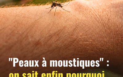“Peaux à moustiques” : on sait enfin pourquoi vous vous faites tout le temps piquer