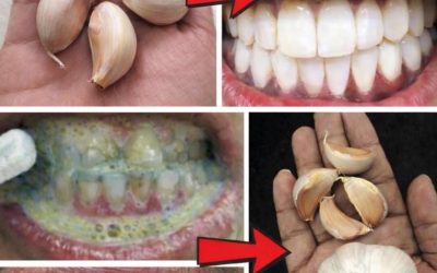 Découvrez les bienfaits naturels de l’ail pour un sourire plus sain