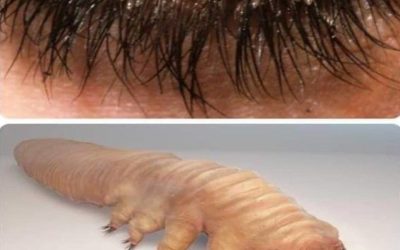 Demodex : comprendre et gérer ces acariens invisibles nichés dans vos cils