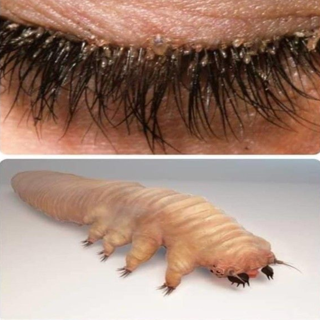 Demodex : comprendre et gérer ces acariens invisibles nichés dans vos cils