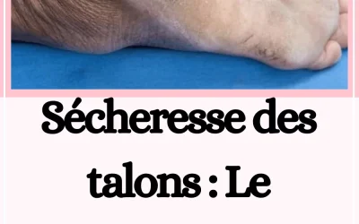 Sécheresse des talons : Le meilleur remède maison